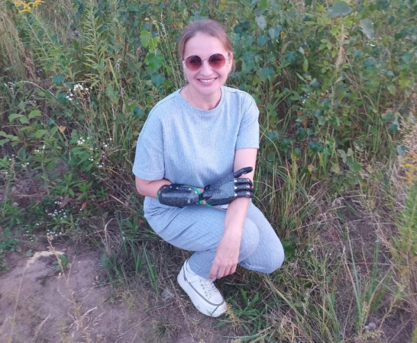 Анна Белова: «Если начинают пялиться, — разворачиваю протез так, чтобы было удобно все рассмотреть»