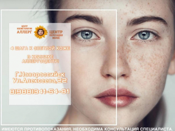 Пигментация кожи: в «АллергоЦентре» Новороссийска знают, как с этим бороться Пигментация кожи: в «АллергоЦентре» Новороссийска знают, как с этим бороться